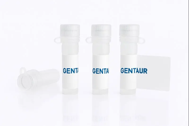 CMKLR1, Human (Cell-Free, His)