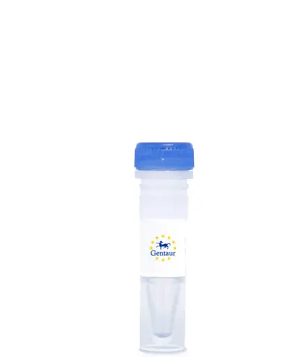 [DASHCHINK-334] CHIKUNGUNYA VIRCLIA® IgM MONOTEST